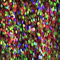 Multi-colored specs are cells on the surface of a zebrafish scale.