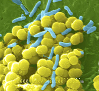Micrografía electrónica de barrido de bacterias