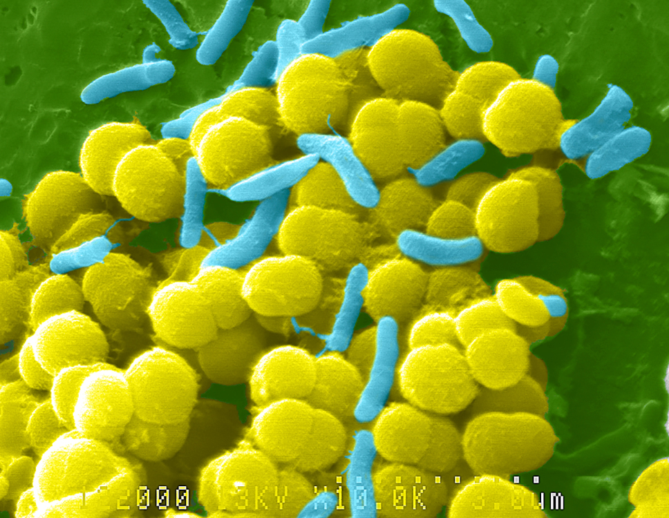 Scanning electron micrograph of bacteria.