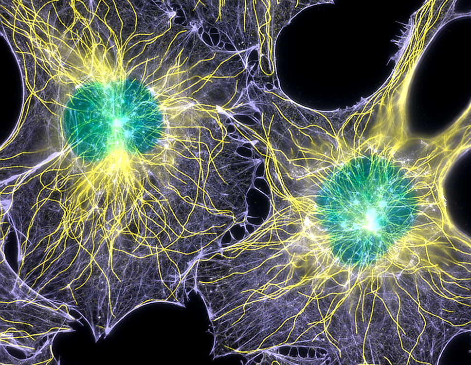 Intricate network of microtubule (yellow, center filaments) and actin filament (purple, outermost) fibers that build a cell's structure.