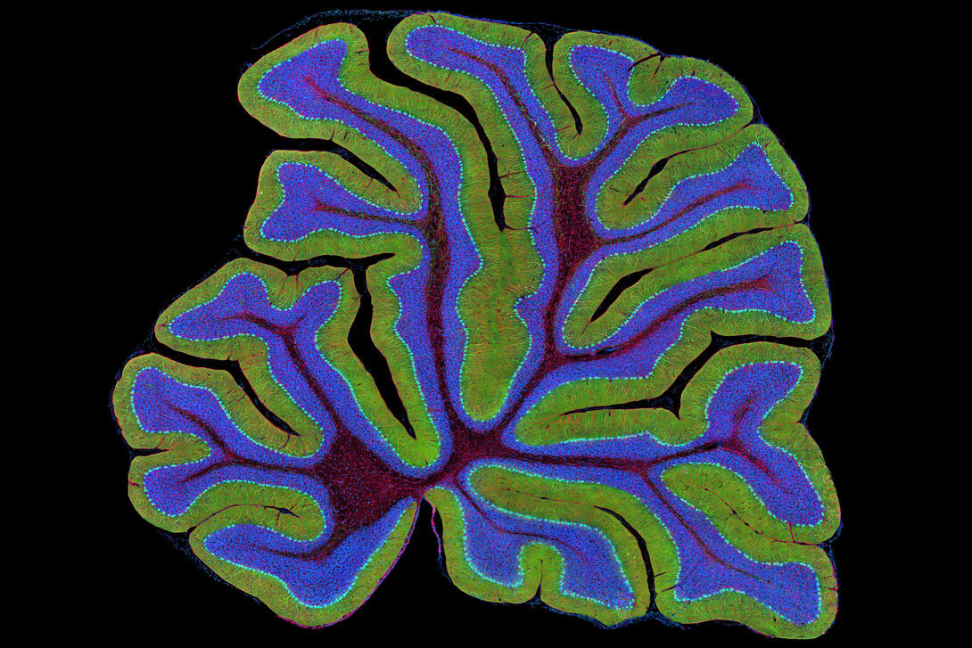1B1_CEREBELLUM_For_Magnifying.