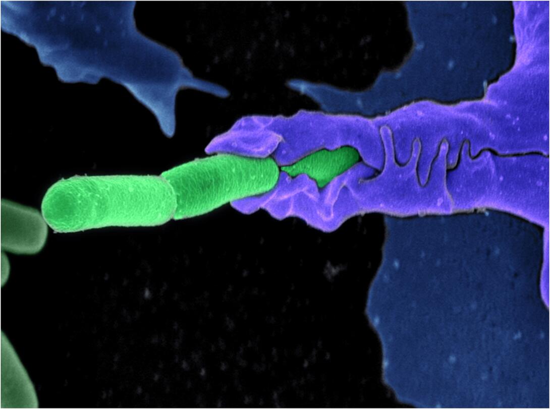 anthrax bacteria images