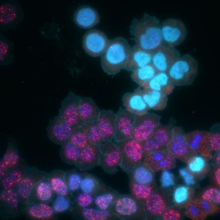 A cluster of light blue cells over clusters of magenta cells intermingled with some blue cells, all against a black background