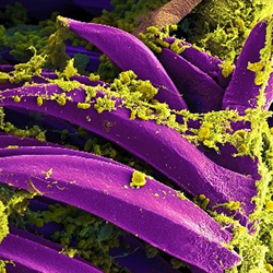 Oblong purple shapes covered in strings of fibrous-looking, yellow clumps.