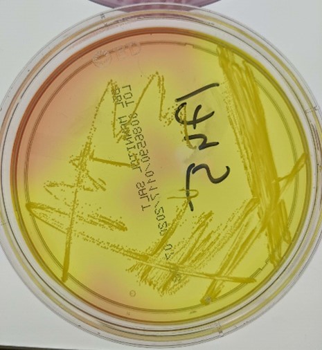 Streaks of bacteria on a round Petri dish.