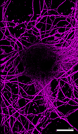 A web of purple threads.