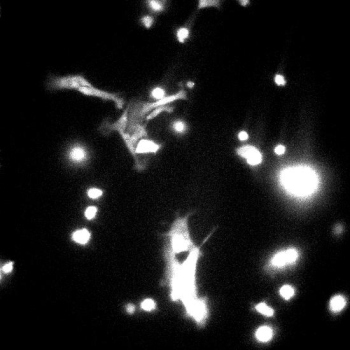 A black background with white spots moving around.