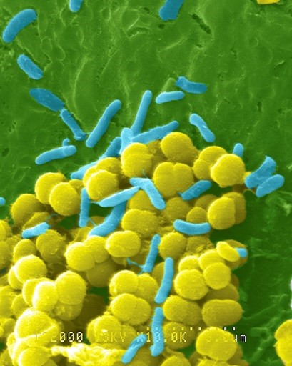 Bacteria shown as many yellow spheres and light blue rods on a green background.