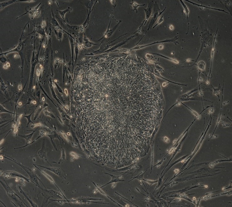 Many long, thin, branching stem cells surrounding an oval cluster of other cells.