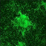 Biofilm
