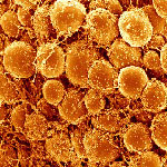 Fat cells