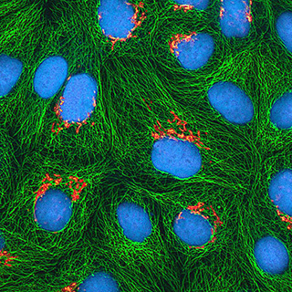Multiphoton fluorescence image of cultured HeLa cells with a fluorescent protein targeted to the Golgi apparatus (orange), microtubules (green) and counterstained for DNA (cyan).  Credit: National Center for Microscopy and Imaging Research 