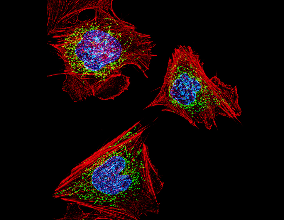 Fibroblast cells with nuclei (blue, circular, center), energy factories (green, surrounding the nucleus), and the actin cytoskeleton (red, outermost).